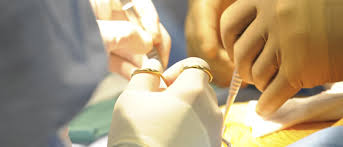 Операция имплантации аортального клапана